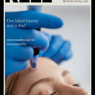 Microneedles can be re game changer in your lasting  glow n timeless beauty !
#skintechcity #skincli