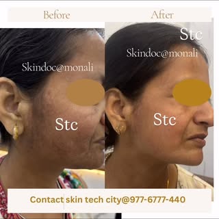 Best place to treat skin issues in Odisha 

Get your deepest skin concern corrected !

Solve pigment