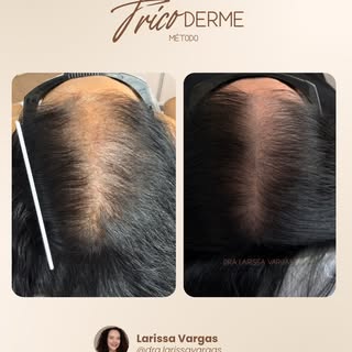 Dos stories para o feed porque vocês curtiram muito esse resultado! Incrível mesmo, né? O método Tri