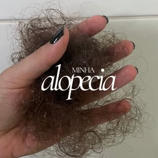 Eu tenho uma alopecia do tipo cicatricial que causa a perda irreversível dos fios se não tratar, por