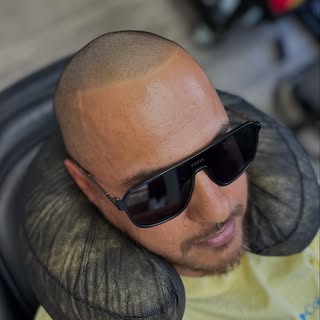 Client satisfaction is always my top priority. This client came in with no hairline, and we helped h
