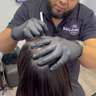 Scalp Micropigmentation (SMP) is a procedure that can create the illusion of thicker hair by adding 