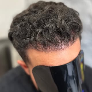 The hair transplant gives you the real hair, but SMP gives you the perfect finish! 

Many clients do