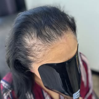Say goodbye to messy hair fibers and hello to permanent density. For women, SMP is the ultimate secr