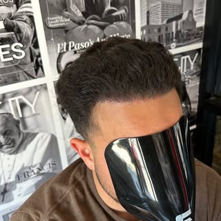 This transformation is known as Scalp Micropigmentation, offering a solution for hair loss by creati