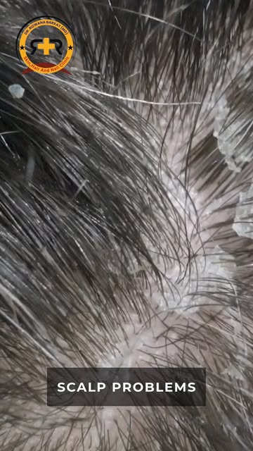 🧴❌ Before you buy another hair serum, find out what’s actually causing your hair loss.

Hair fall c
