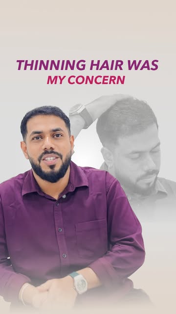 Thinking about a Hair Transplant? See the journey before making your decision.

From the initial con