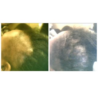 These are real results after a hair and scalp spa analysis. After reviewing your results, we will be