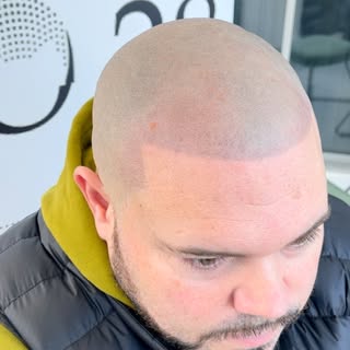 🔥Sharp or Natural Hairline the choice is yours with SMP🔥 #fixuplooksharp #sharphairline #smp #fres