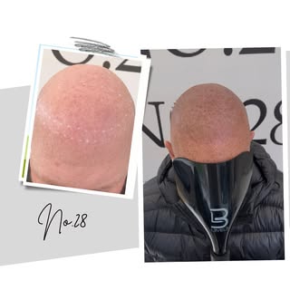 🔥Light & Natural for this Gent🔥Interested in SMP treatment WhatsApp Any Questions you have to 0736