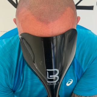 😎 Another Topman summer ready 😎 #summervibes☀️ #lookgoodfeelgood #smp #scalpmicropigmentation #war