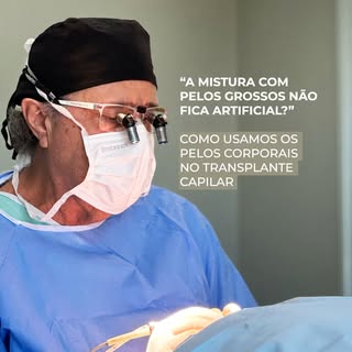 Essa é a dúvida nº1 de quem vai fazer transplante com pelos corporais: como fica o crescimento do ca
