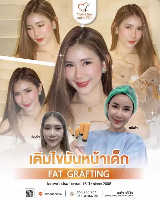 ✨ หน้าเด็กขึ้นแบบเป็นธรรมชาติ ไม่ต้องเปลี่ยนความเป็นตัวเอง ✨

อีกหนึ่งรีวิวเติมไขมันหน้าเด็ก ที่ช่วย