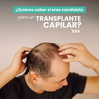 No todas las personas con caída de cabello son candidatas a un trasplante capilar.

Y ahí está la di