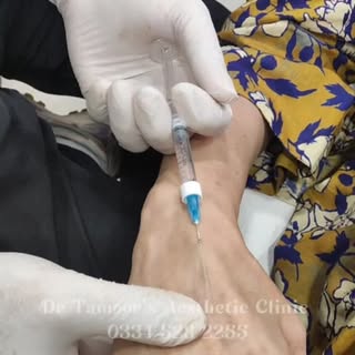 Hand Fillers at Dr Tamoor's Aesthetic Clinic Islamabad #handfiller #handrejuvenation #antiaging #fil
