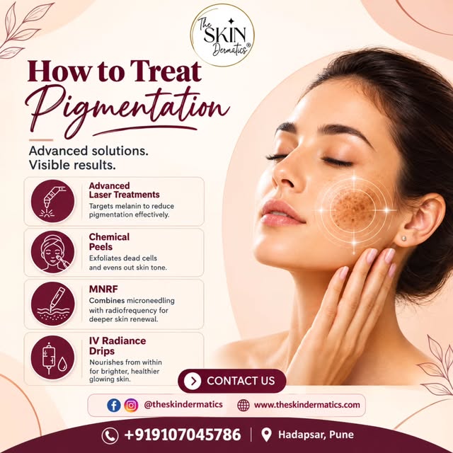 ✨ Struggling with Pigmentation & Uneven Skin Tone? ✨

Say goodbye to stubborn pigmentation with adva