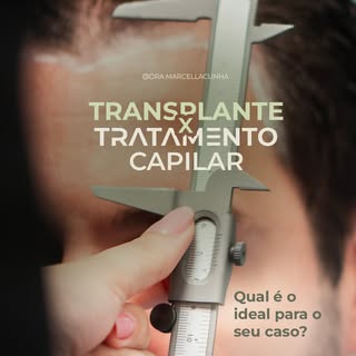 Transplante capilar e tratamento não são escolhas opostas.

Se você tem dúvidas entre iniciar um tra