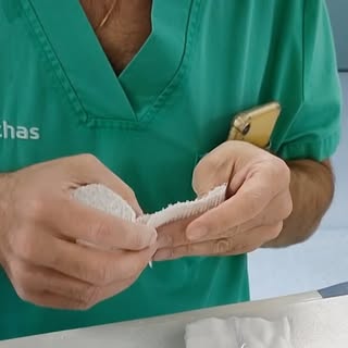 Todo es importante al realizar una #rinoplastia por eso me gusta hacerme cargo incluso de los pequeñ