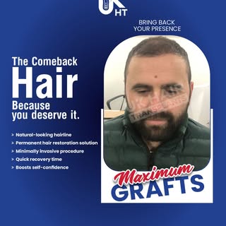 ✨ Your Hair Comeback Starts Here! ✨

A fuller, natural-looking hairline is more than just a transfor