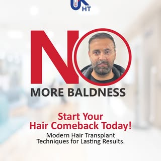 🚫 Say NO to Baldness! 👨‍🦱✨

It's time to regain your confidence with advanced hair transplant sol