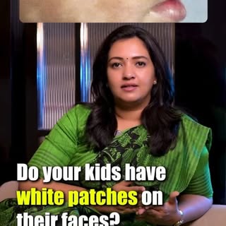 Do your kids have white patches on their faces?

#whitepatches #kidsskincare #dermatologist #drashwi