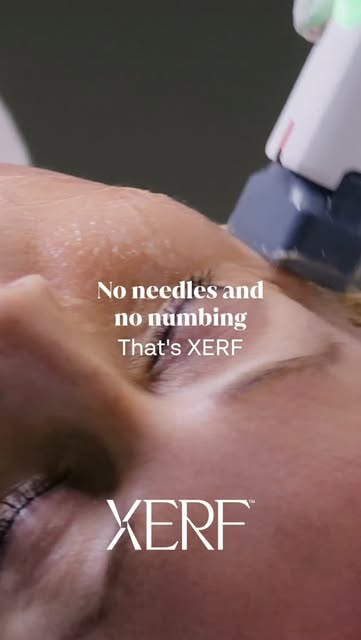 #comfortable 
#noneedles 
#nonumbing 

#XERF