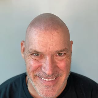 EVERY REASON TO BEAM 
 <<<SWIPE<<<
INKREASE SMP 
Scalp Micropigmentation 
Fort Worth Texas