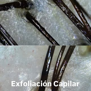 Nuestra famosa exfoliación capilar 🫶🏼✨ que todas y todos terminan amando!

Si sufres de caída, exc