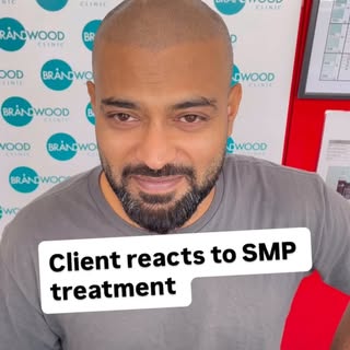 His reaction says it all.

Seeing our client’s face after his Scalp Micropigmentation treatment is e