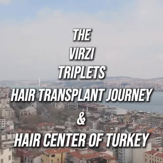 🎥 Hair Transplant Journey of the @virzitriplets 

Three brothers, one journey.
We performed hair tr