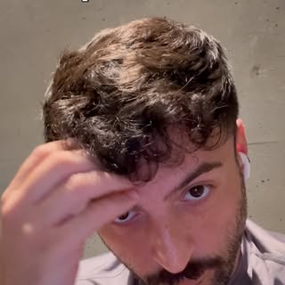 Sometimes it be like that 💆‍♂️ #hairtransplant #hairlinerestoration #hairline #hairloss #ıstanbul #