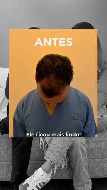 Tem gente que tem medo até de uma gripinha… imagina de transplante capilar? 😅

É assim que a esposa