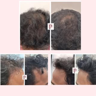 Your hair is a crown you wear every day — don’t hand it over to myths and social media experts. Scie