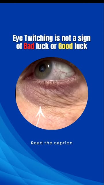 Eye Twitching? 👁️

That random eyelid twitch can be annoying—but in most cases, it’s harmless and t