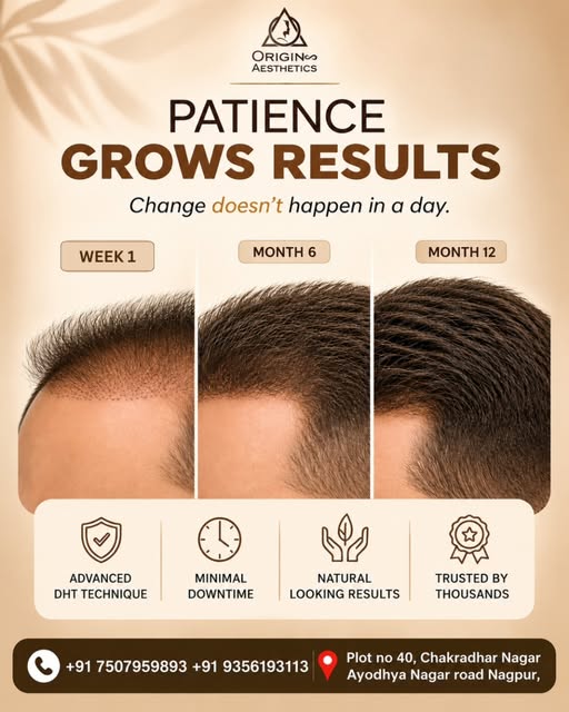 🌱 PATIENCE GROWS RESULTS — SO DOES YOUR HAIR.

A hair transplant isn’t an overnight transformation.