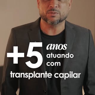 A calvice afeta a vida de milhões de brasileiros de diversas formas: fisicamente, socialmente e abal