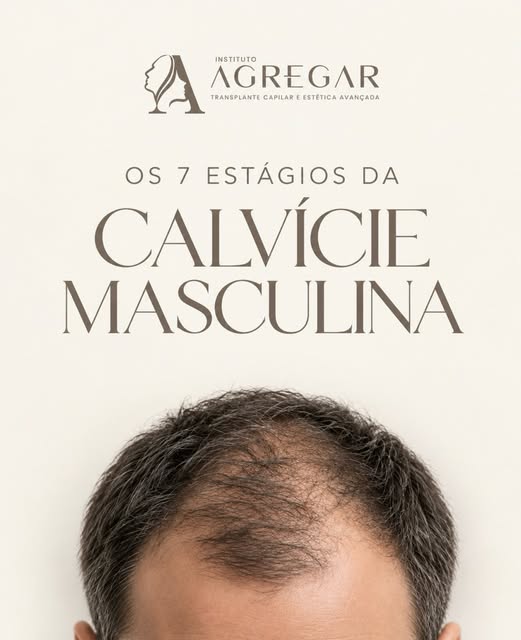 Perceber a queda de cabelo e as mudanças na densidade dos fios pode gerar muitas dúvidas, principalm