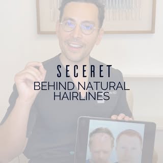Ever wondered why some hair transplants look completely undetectable while others don’t? 🤔

Dr. Asi