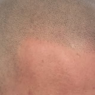 Fair skin and hair can be a challenging combination, you need the right pigment and needles for the 