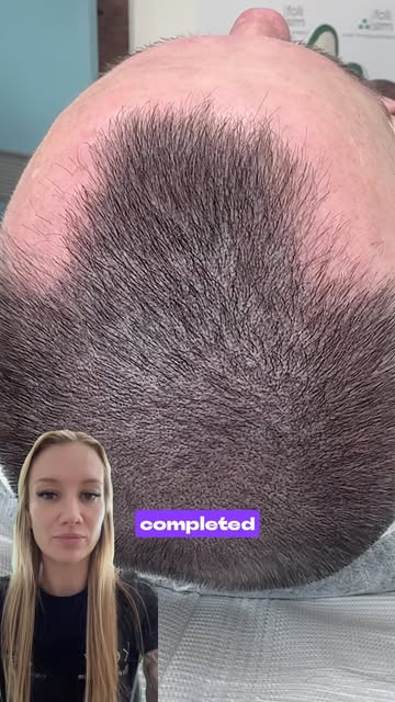 This is how a density treatment should look.

If you saw my previous post (4th of August), you have 