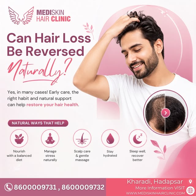 Can Hair Loss Be Reversed Naturally? 💇♂️
Healthy hair starts with the right care, early attention, 