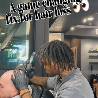 What is SMP?
Scalp Micropigmentation is a revolutionary, non-surgical hair loss solution that replic
