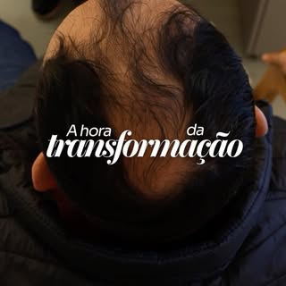 Aviso Institucional

Este perfil é destinado à divulgação de conteúdos informativos sobre transplant