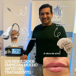 Muchos creen que un buen resultado depende únicamente del producto o del tratamiento.

Yo creo que e