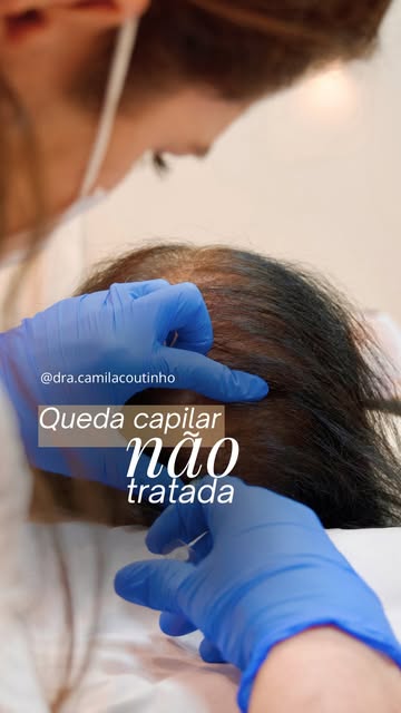 Queda capilar não tratada não é só uma questão de estética.

Com o tempo, os fios podem ficar cada v