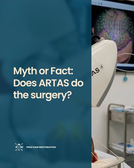 MYTH OR FACT: ARTAS robotic technology does the entire hair transplant on its own. MYTH. ARTAS is an