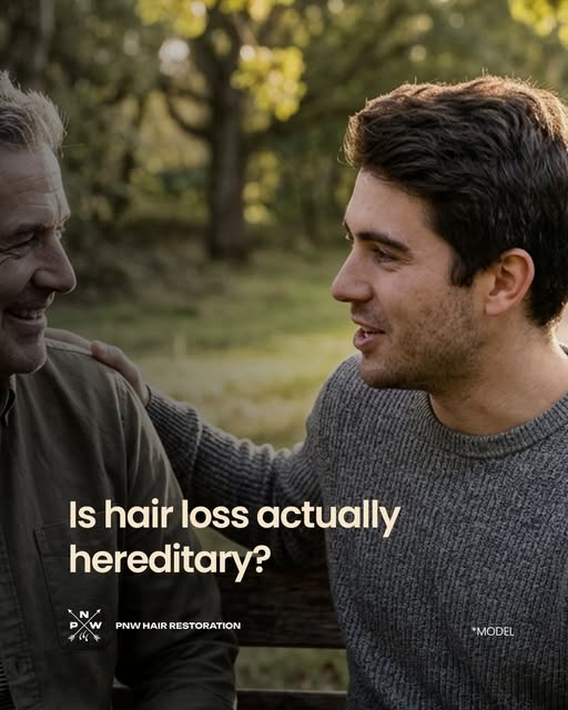 Genetics play a major role in most cases of hair loss, particularly male and female pattern hair los