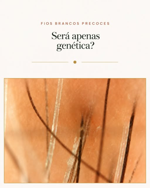 Fios brancos surgindo precocemente: será apenas genética? 🤍

A hereditariedade costuma ser o princi