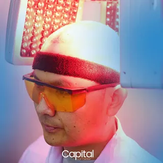 Experience the transformative power of hair transplant and let us help you achieve your dream strand