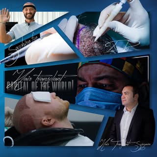 Sapphire FUE vs DHI, how do you know which is right for you?
💎 Sapphire FUE 
Sapphire FUE hair tran